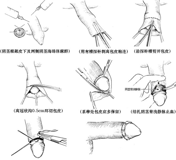 應(yīng)急預(yù)案 第15頁